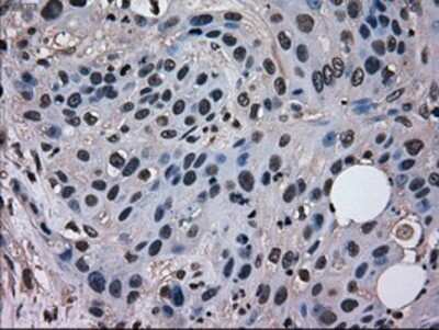Immunohistochemistry: EI2BL Antibody (OTI9H7) - Azide and BSA Free [NBP2-72280]