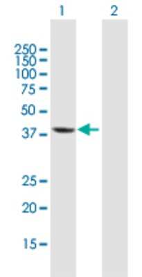 Western Blot: EI2BL Antibody [H00084245-B01P]