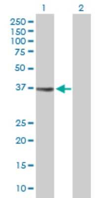 Western Blot: EI2BL Antibody [H00084245-D01P]