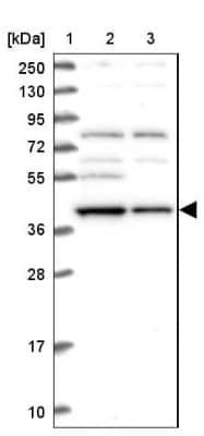 Western Blot: EI2BL Antibody [NBP2-47475]