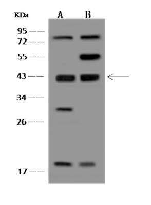 Western Blot: EI2BL Antibody [NBP3-06310]