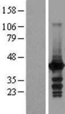 Western Blot: EI2BL Overexpression Lysate [NBL1-13065]