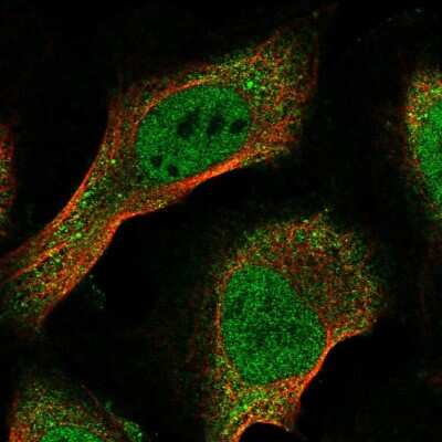 Immunocytochemistry/ Immunofluorescence: EID1 Antibody [NBP2-47355]