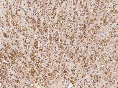 Immunohistochemistry: EID1 Antibody [NBP2-97540]