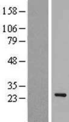 Western Blot: EID1 Overexpression Lysate [NBP2-07353]