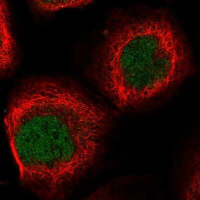 Immunocytochemistry/ Immunofluorescence: EID2 Antibody [NBP1-94096]