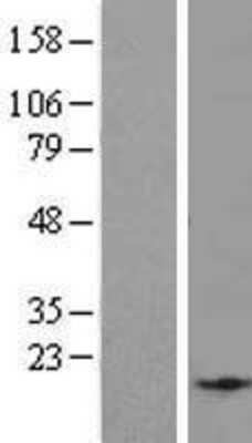 Western Blot: EID2B Overexpression Lysate [NBL1-10167]