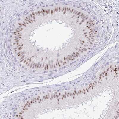 Immunohistochemistry-Paraffin: EID3 Antibody [NBP2-32455]