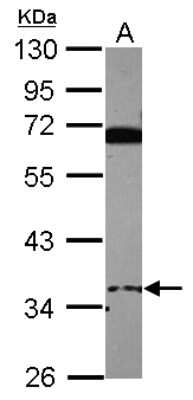 Western Blot: EID3 Antibody [NBP2-14943]