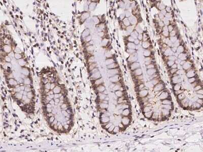 Immunohistochemistry: EIF1A Antibody [NBP2-98066]