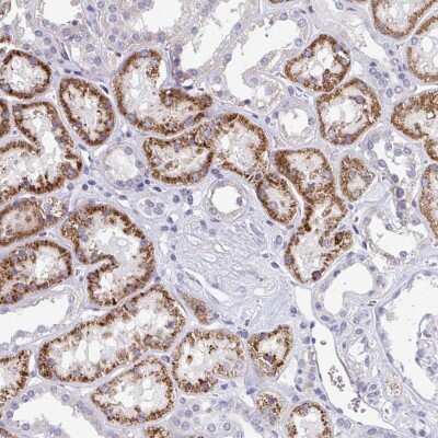 Immunohistochemistry: EIF1AD Antibody [NBP2-31591]