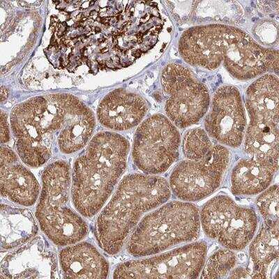 Immunohistochemistry-Paraffin: EIF1AD Antibody [NBP2-31728]