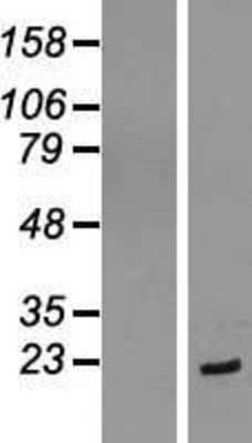 Western Blot: EIF1AX Overexpression Lysate [NBL1-10171]