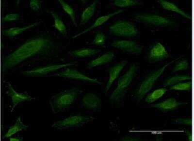 Immunocytochemistry/ Immunofluorescence: EIF1A Antibody (2B8) [H00009086-M03]