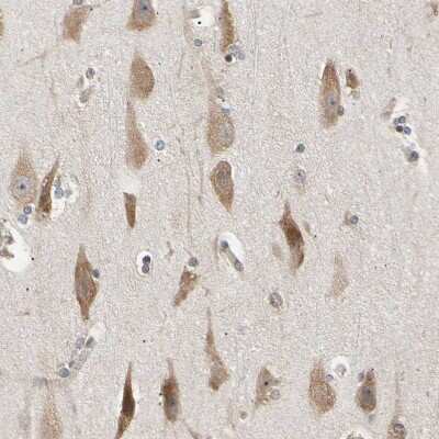 Immunohistochemistry-Paraffin: EIF1A Antibody [NBP1-85808]