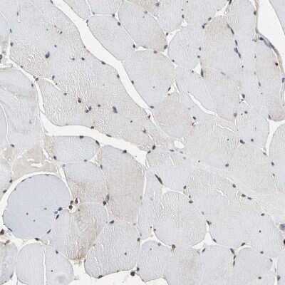 Immunohistochemistry-Paraffin: EIF1A Antibody [NBP1-85808]
