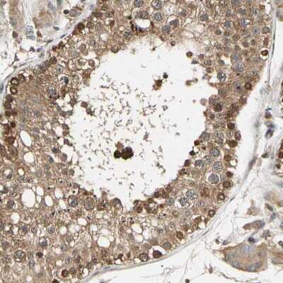 Immunohistochemistry-Paraffin: EIF1A Antibody [NBP1-85808]