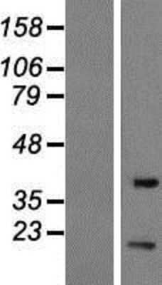 Western Blot: EIF1B Overexpression Lysate [NBP2-07692]