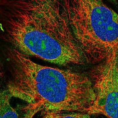 Immunocytochemistry/ Immunofluorescence: EIF2 beta Antibody [NBP2-38483]