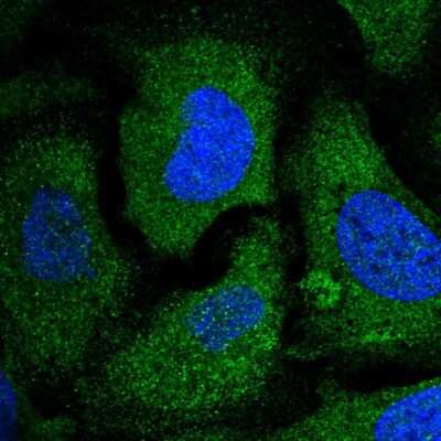 Immunocytochemistry/ Immunofluorescence: EIF2 beta Antibody [NBP2-58948]