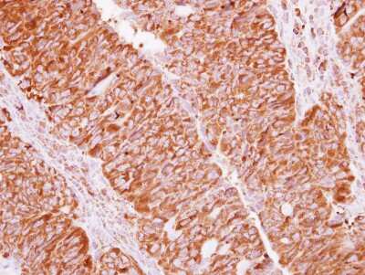 Immunohistochemistry-Paraffin: EIF2 beta Antibody [NBP2-16290]