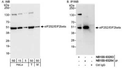 Western Blot: EIF2 beta Antibody [NB100-93283]