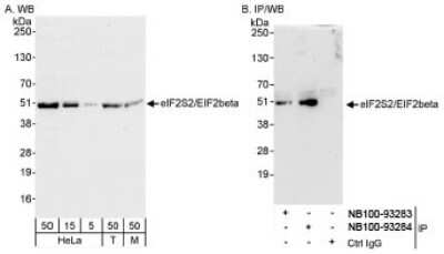 Western Blot: EIF2 beta Antibody [NB100-93284]