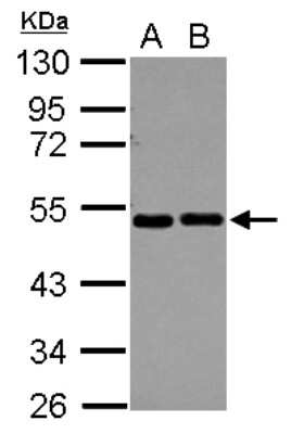 Western Blot: EIF2 beta Antibody [NBP2-16290]