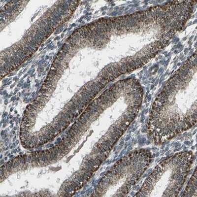 Immunohistochemistry-Paraffin: EIF2AK1 Antibody [NBP1-83210]