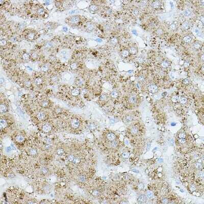Immunohistochemistry-Paraffin: EIF2AK1 Antibody - BSA Free [NBP3-05000]