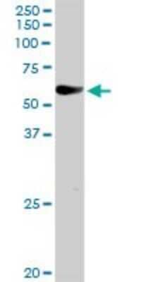 Western Blot: EIF2AK1 Antibody [H00027102-D01P]