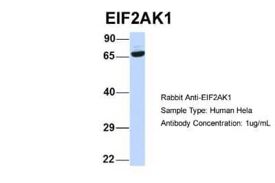 Western Blot: EIF2AK1 Antibody [NBP1-56484]