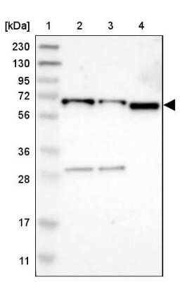 Western Blot: EIF2AK1 Antibody [NBP1-83210]