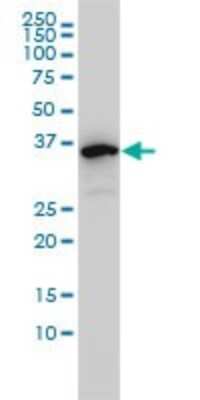 Western Blot: EIF2B2 Antibody (5B12-E10) [H00008892-M01]