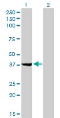 Western Blot: EIF2B2 Antibody (5B12-E10) [H00008892-M01]