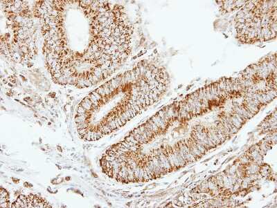 Immunohistochemistry-Paraffin: EIF2B2 Antibody [NBP1-33557]