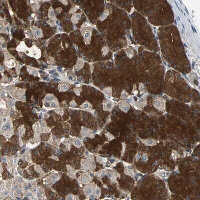 Immunohistochemistry-Paraffin: EIF2B2 Antibody [NBP1-84877]