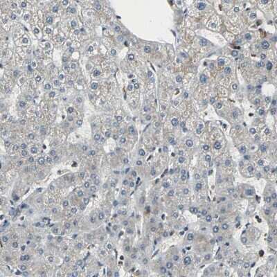 Immunohistochemistry-Paraffin: EIF2B2 Antibody [NBP1-84877]