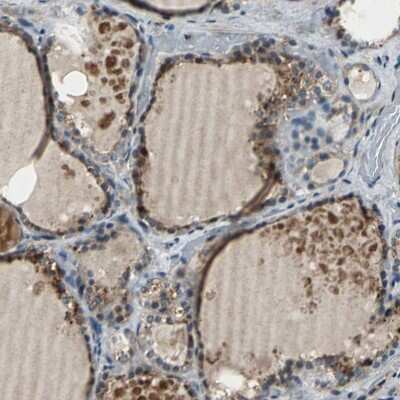 Immunohistochemistry-Paraffin: EIF2B2 Antibody [NBP1-84877]