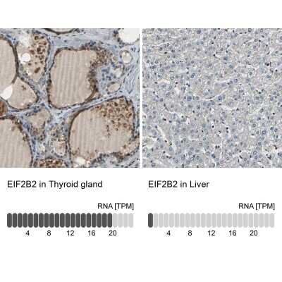 Immunohistochemistry-Paraffin: EIF2B2 Antibody [NBP1-84877]