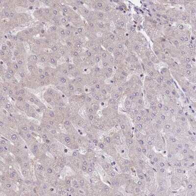 Immunohistochemistry-Paraffin: EIF2B2 Antibody [NBP2-38572]