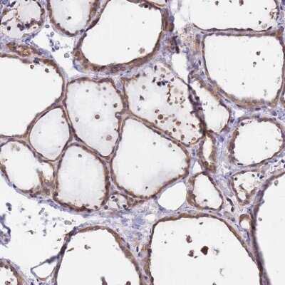 Immunohistochemistry-Paraffin: EIF2B2 Antibody [NBP2-38572]