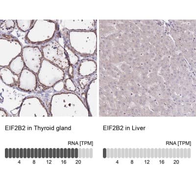 Immunohistochemistry-Paraffin: EIF2B2 Antibody [NBP2-38572]