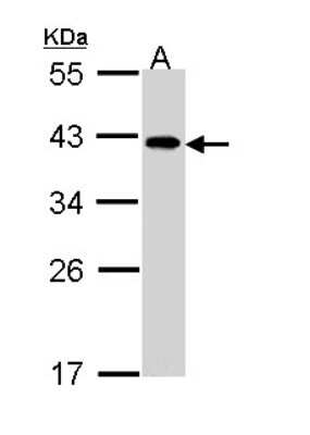 Western Blot: EIF2B2 Antibody [NBP1-33557]