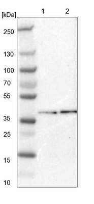 Western Blot: EIF2B2 Antibody [NBP1-84877]