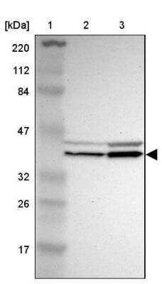 Western Blot: EIF2B2 Antibody [NBP1-84877]