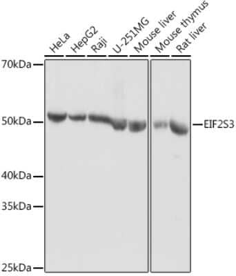 Western Blot: EIF2G AntibodyAzide and BSA Free [NBP3-03513]