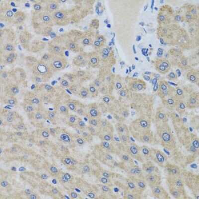 Immunohistochemistry-Paraffin: EIF2G Antibody - Azide and BSA Free [NBP3-03513]