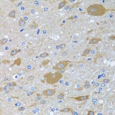 Immunohistochemistry-Paraffin: EIF2G Antibody - Azide and BSA Free [NBP3-03513]