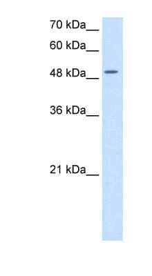 Western Blot: EIF2G Antibody [NBP1-53087]